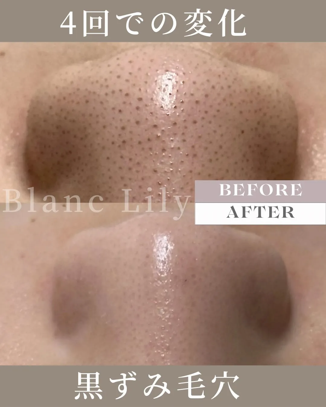 当サロンの症例写真です