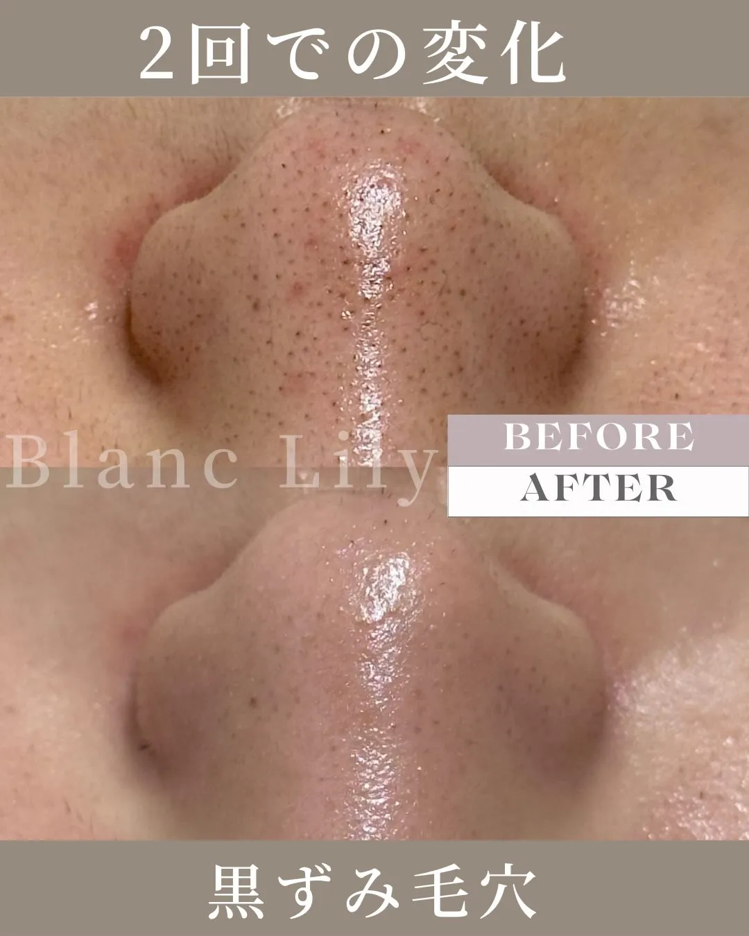 ※掲載許可いただいています🉑