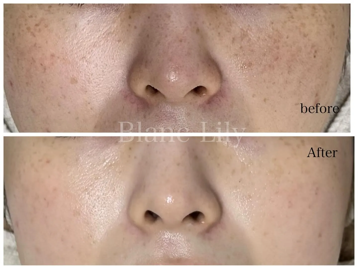 お通いいただいているお客様の一部ですが症例です💛