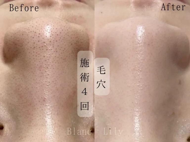 お通いいただいているお客様の一部ですが症例です💛