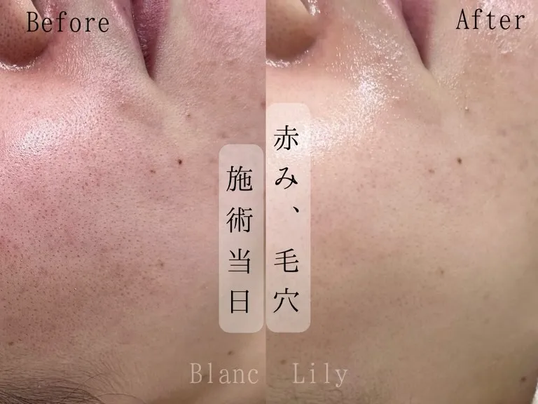 お通いいただいているお客様の一部ですが症例です💛