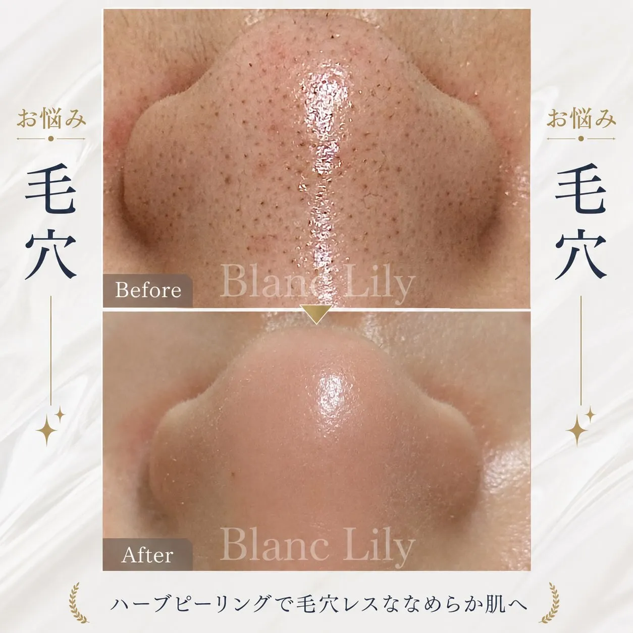 🎉✨ Blanc Lily 1周年記念イベント開催✨🎉